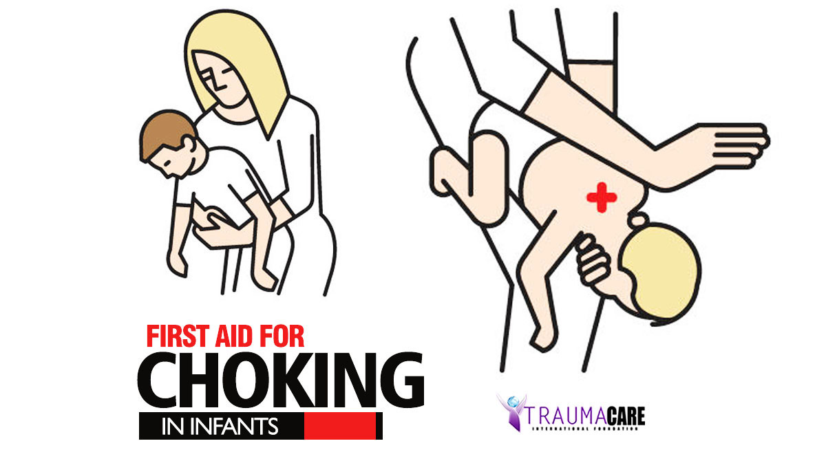 FIRST AID FOR CHOKING INFANTS